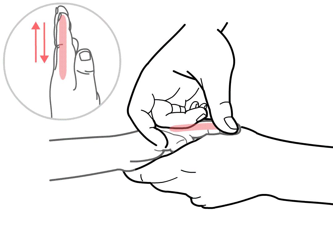 宝宝拉羊屎蛋怎么处理,宝宝拉羊屎蛋最快的解决方法