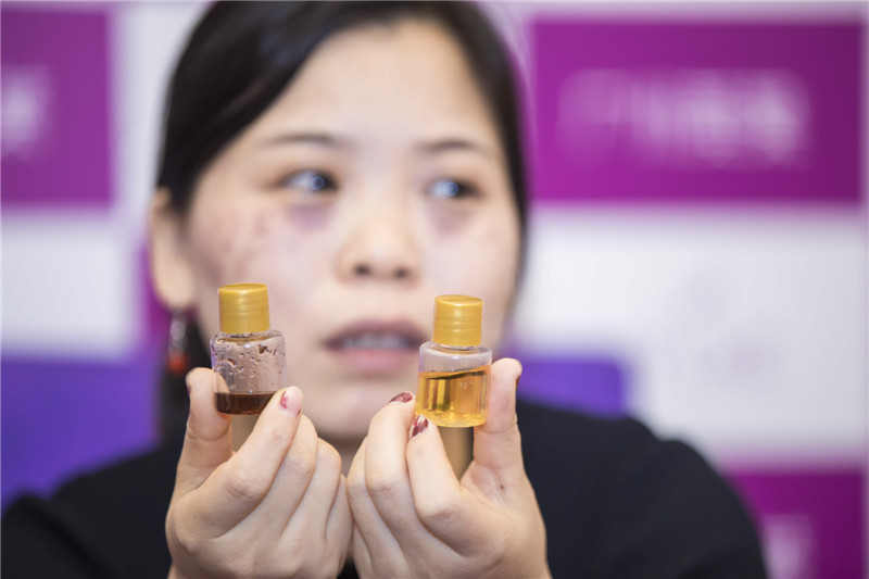 街边化妆店体验雀斑,化妆品店祛雀斑不用店内产品