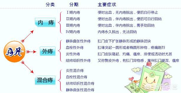 痔疮手术要怎么做,得了痔疮想要做个小手术怎么做