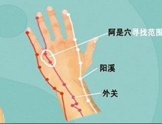 湿疹发作记住这些方法远离湿疹,湿疹很严重反反复复怎么治疗