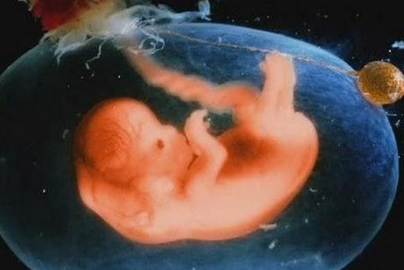 中央型胎盘前置有什么方法可改善,查出完全性前置胎盘怎么办