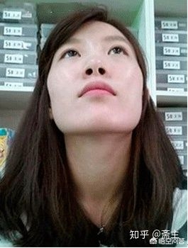 咬肌大脸颊凹适合瘦脸吗,下颌骨宽咬肌大如何瘦脸