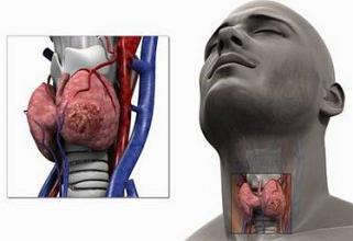 甲状腺疾病民间偏方真相大求真，想快速康复，你该小心了！