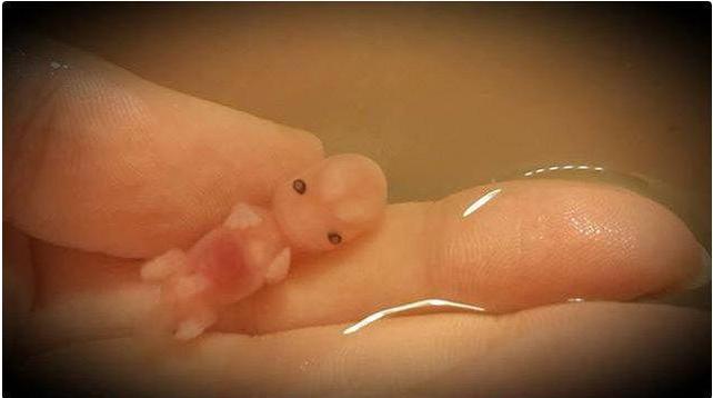 肚子里的胎宝宝停胎了，小月子里，我还是泪流不止，我该怎么办？