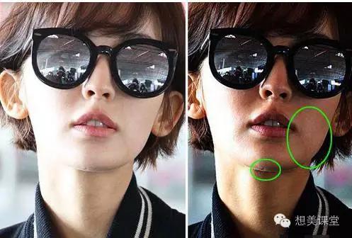 脸再美妆再浓，一颗痘痘毁你容！