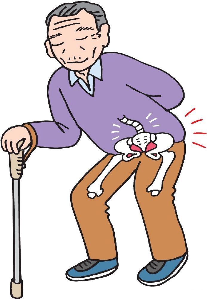 腰椎疼痛及治疗,有什么好办法不手术能治疗腰椎疼