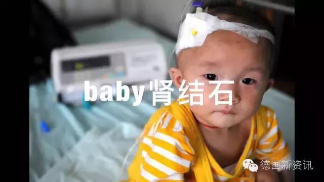 德国爱他美奶粉价格表大全,德国爱他美奶粉成块怎么回事