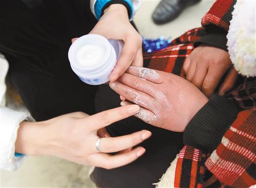 宝宝预防冻疮的有效方法,宝宝冻疮怎么根治