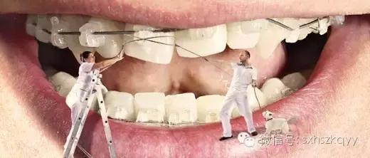 常见排齐牙齿的四大方法,牙齿拥挤重叠矫正过程