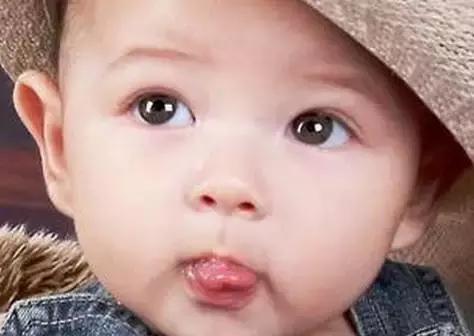 宝宝咬到舌头吃什么,孩子吃饭咬到嘴巴侧边的肉