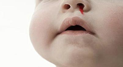 幼儿园安全常识视频应急科普 (幼儿园儿童安全急救知识大全)