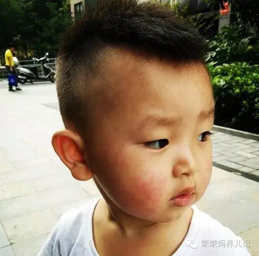 急性乳腺炎怎么按摩通奶教程,乳腺炎最佳自救方法