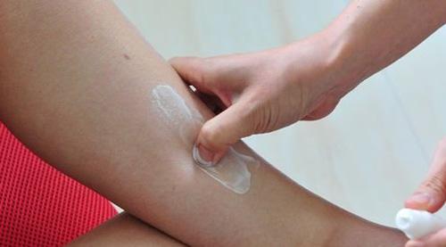 湿疹的最佳治疗药物,湿疹擦什么药膏效果好能治好