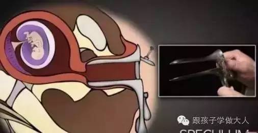 准妈产检生产都用过这些冰冷医疗仪器，看的心惊肉跳！