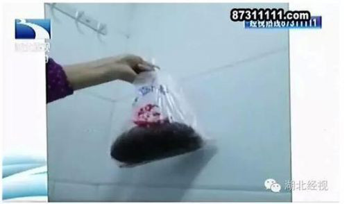 医院胎盘有必要留吗,医院的胎盘有什么用