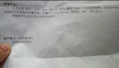 流褐色分泌物但胎心正常会胎停嘛,有胎心胎芽了流出褐色分泌物