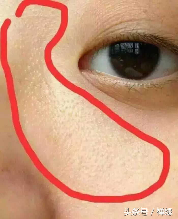 产后皮肤暗黄需要怎么护肤,产后皮肤暗黄还长痘怎么办