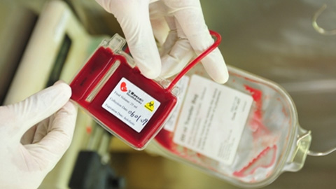 脐带血留还是不留,脐带血存在还是不存