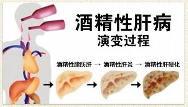 酒精肝危害有多大,酒精肝严重的危害