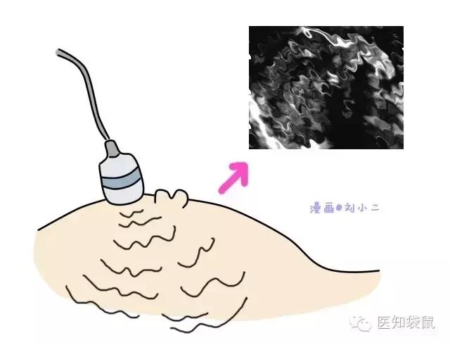 普通b超和肾b超检查范围一样吗,B超三维彩超区别