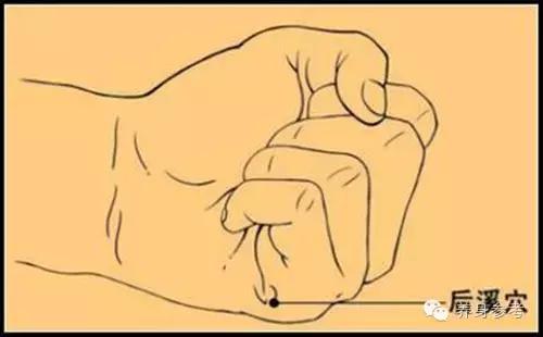 董氏奇穴治疗偏头痛,生小孩神经痛针灸