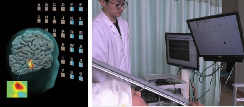 霍金脑机接口原理,从霍金到爱因斯坦的宇宙视频