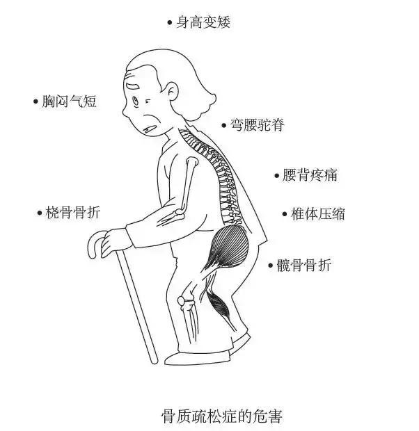 太极拳二十四式能改善骨质疏松吗,治骨质疏松运动