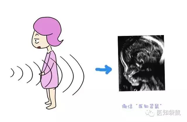 普通b超和肾b超检查范围一样吗,B超三维彩超区别