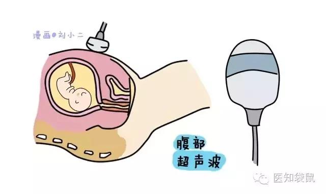 B超三维彩超区别,普通b超能看清胎儿颅内结构吗