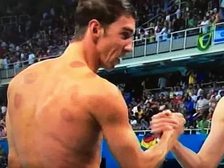 作为一个有同样爱好的老陕我必须提醒菲尔普斯:拔罐后不能下水！