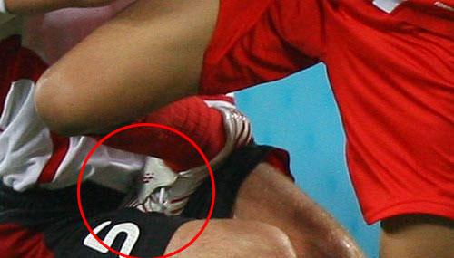 盘点足坛那些打架暴怒的时刻,足坛十大斗殴狠人