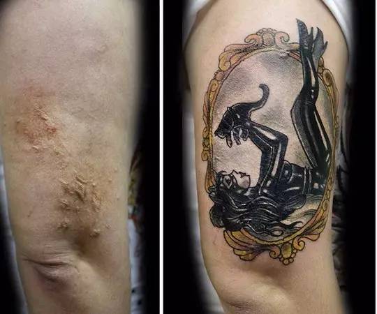 将疤痕变成灿烂花朵美女刺青师精心修复身体伤口