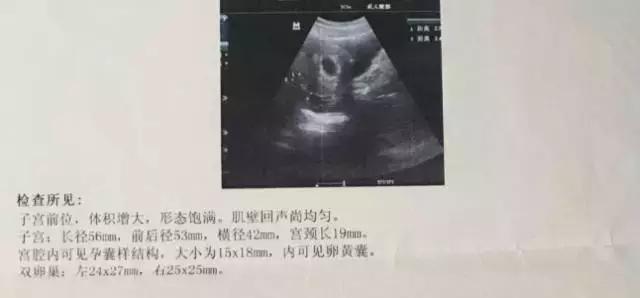 怀孕6周做b超需要憋尿吗,怀孕六周第一次b超图片