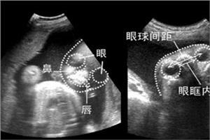 怀孕期间婆婆做菜特别简单,孕妇婆婆做菜