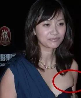 怎样减腋下赘肉,教你甩掉烦人赘肉