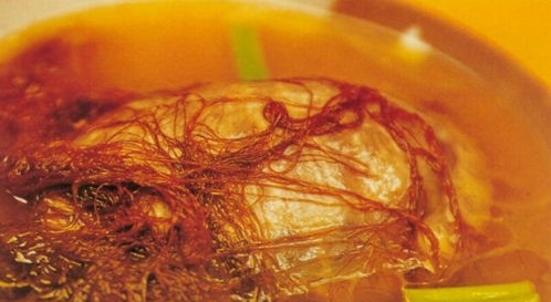 女性出现功血有什么危害,女性功血后怎么补血