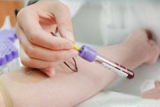 妊娠糖尿病糖筛隔多久复查,第一次糖耐检查偏高怎么办