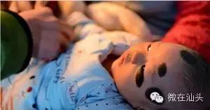 一图读懂什么样的痣易癌变,点痣后增生了肉痣会变癌吗