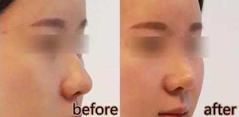 怎样才能有好看额头,干货怎么塑造价值