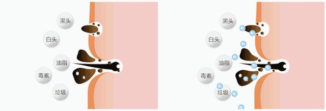 火山泥真的能清洁毛孔吗,用火山泥洗脸再用洗面奶