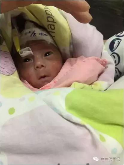 导致早产的重要原因是,导致早产的5种原因