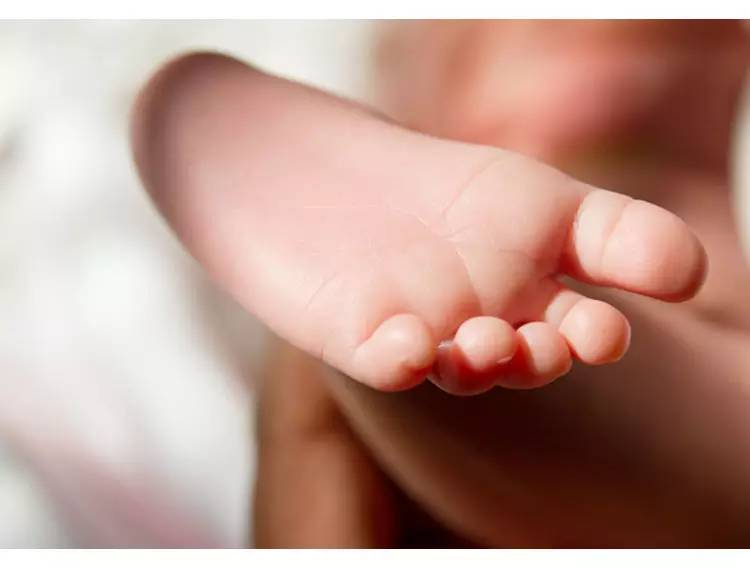 宝宝脚起像水泡一样的皮怎么回事,宝宝脚长满水泡
