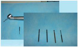 苏州无痛微创拔牙,无痛拔牙科普视频