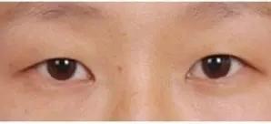 做美瞳线的技巧和方法,教你如何选择美瞳线