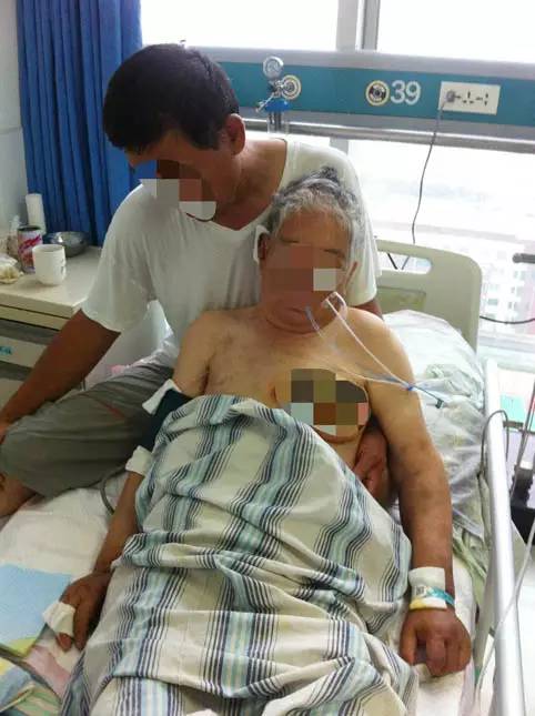 惨不忍睹！东营76岁老人疑遭儿媳虐待！乳房被烙铁烫平肋骨断裂