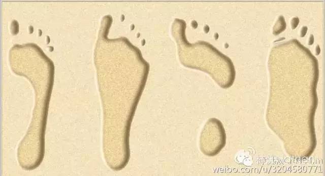 扁平足矫正训练法,扁平足物理治疗能不能恢复足弓