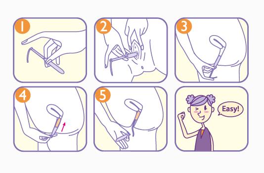 卫生棉条如何正确使用，用了卫生棉条还会侧漏吗？