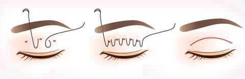 为什么大家都喜欢大眼睛双眼皮,为什么大家喜欢做双眼皮手术