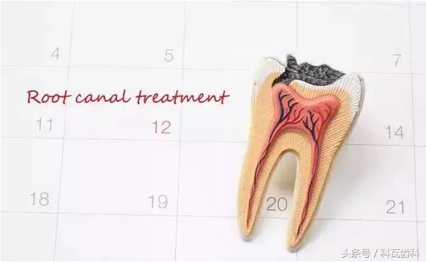 抽牙神经根管治疗过程,抽神经的症状和危害