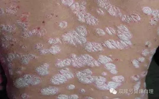 中医说吃醪糟的好处,中医说伤阴最严重症状